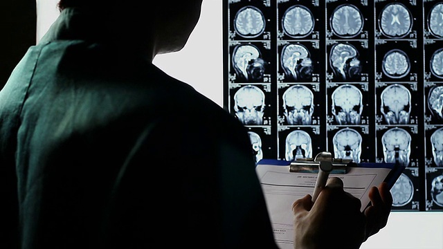 检查头骨脑部x光扫描，做笔记，作出诊断视频下载