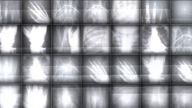 X射线图片背景视频素材