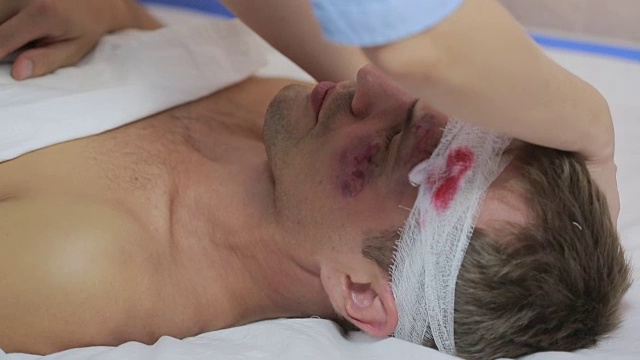 护士用绷带包扎头部。一个脸上有淤青的受伤男子视频下载