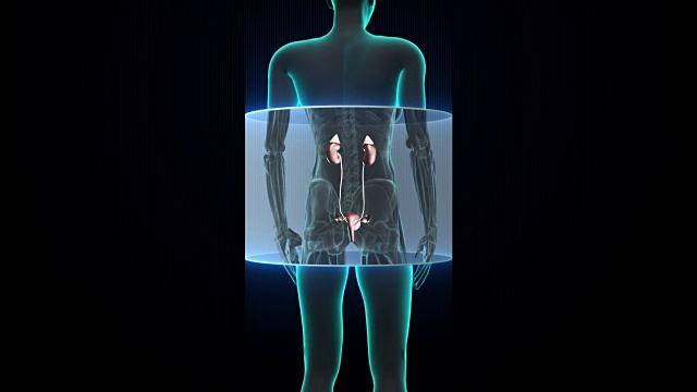 扫描女性肾脏。x射线的观点视频素材