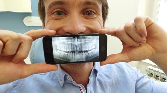 近距离的男子拿着智能手机与照片的牙科x光在牙医视频下载