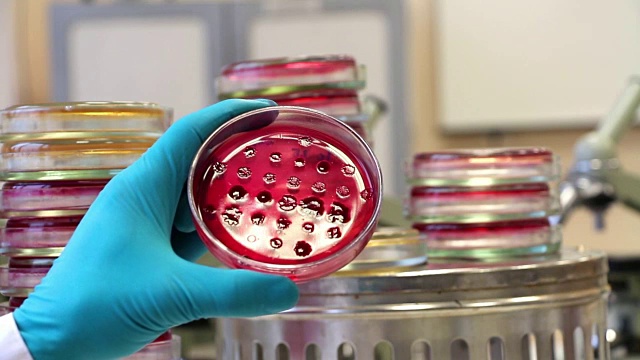 科学家检查装满肠道细菌的Endo培养皿视频下载
