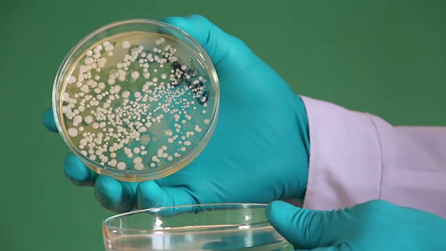 实验室技术员打开了覆盖着菌落的培养皿视频下载