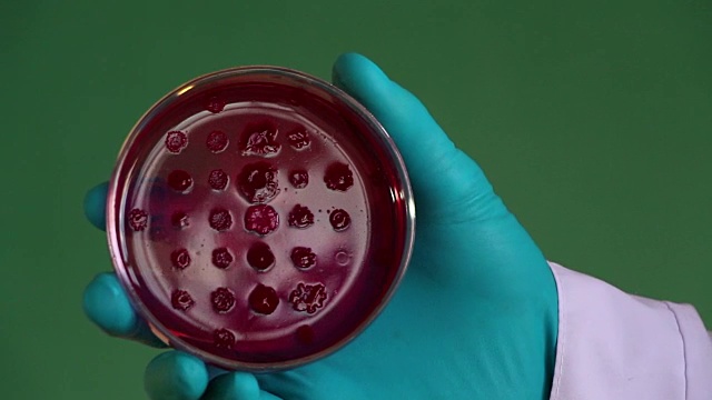 细菌学家在绿色背景下检查Endo培养皿视频下载