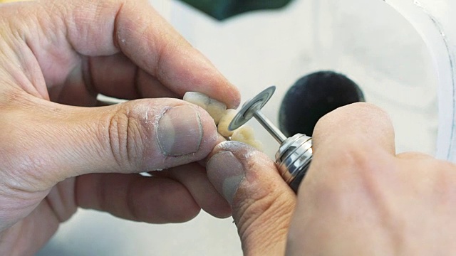 磨牙冠与仪器在牙科实验室的特写视频下载