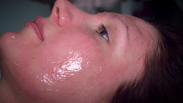 4K医生在妇女脸上应用凝胶程序视频素材