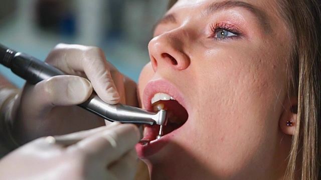 牙科诊所的牙齿抛光视频素材