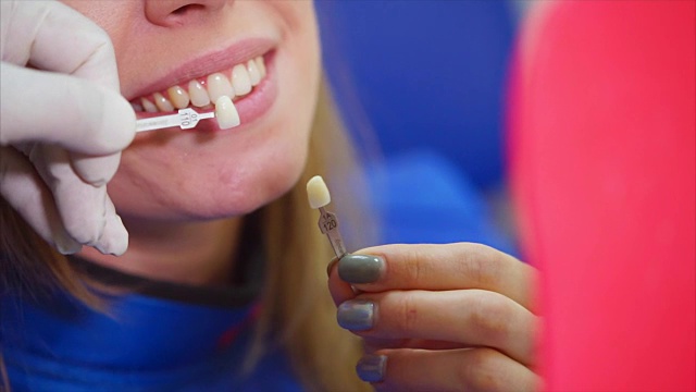 近距离拍摄的一个女人的嘴谁检查她的牙齿如何漂白视频下载