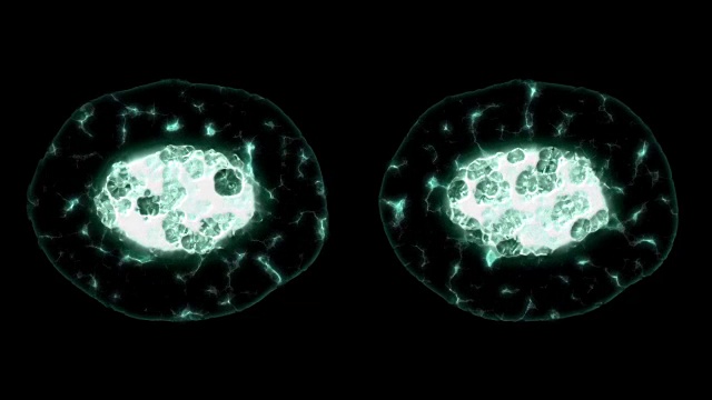 有丝分裂、分裂或生殖细胞的显微图视频下载