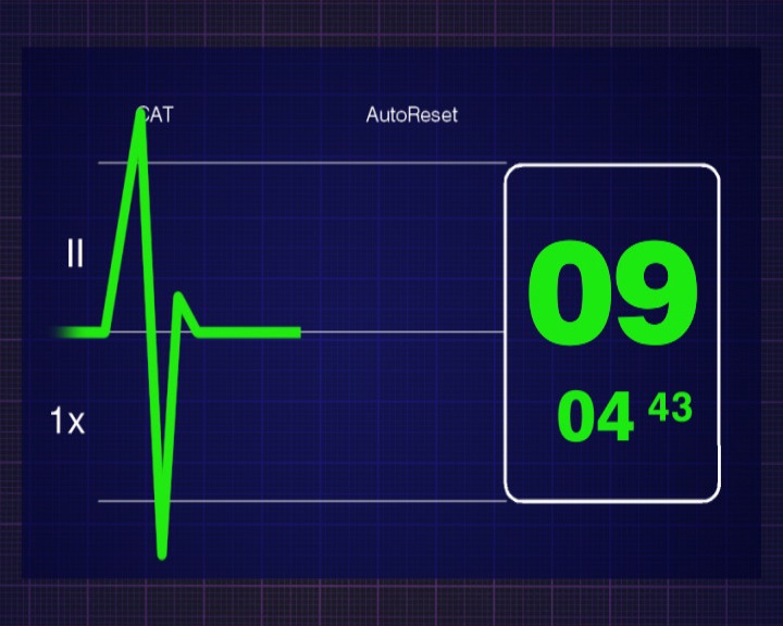 一个人的心脏脉搏跟踪的特写与倒计时在电脑屏幕上视频下载