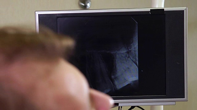 女牙医在屏幕上向男病人展示他的x光扫描图视频素材