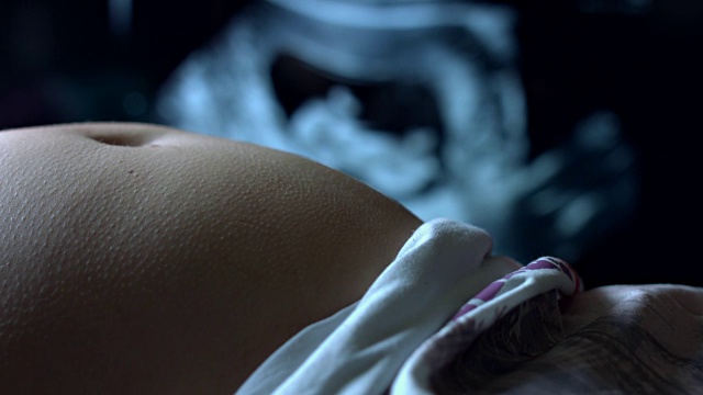 4K孕妇腹部超声与监视器背景视频素材