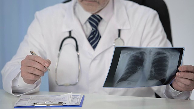 看肺部x光片并给病人开治疗处方的肺科医生视频素材