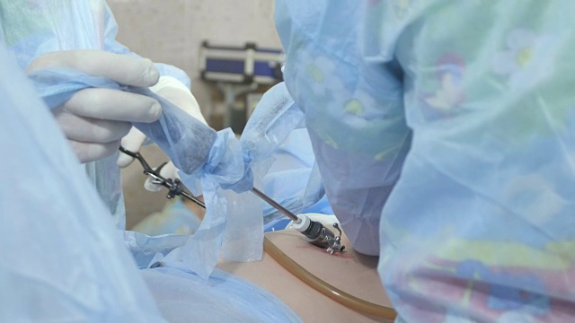 外科医生进行腹腔镜手术视频素材
