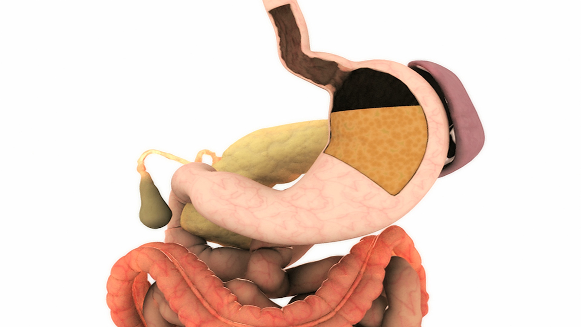 胃食管反流病或GERD的动画。当胃液上升到食道，再回到食道时，摄像机就会聚焦到切开的胃和食道。视频素材