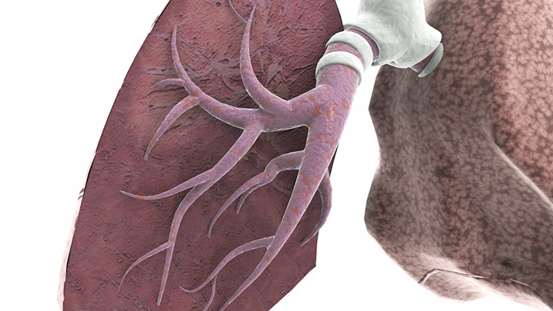 右肺被切除以显示内支气管的一段放大肺的动画。视频下载