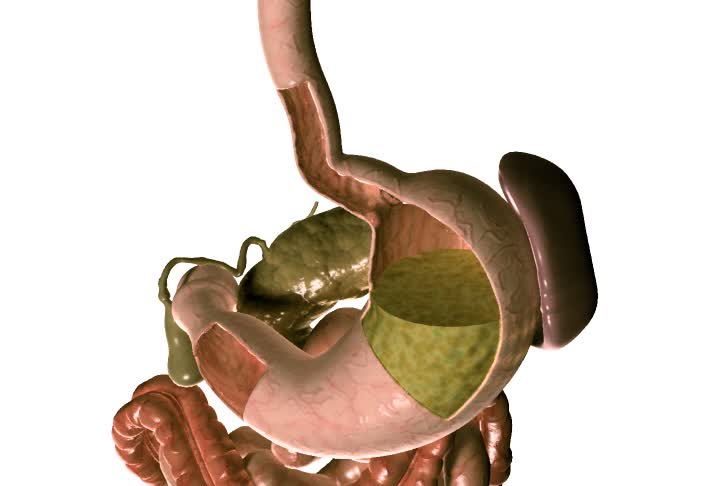 摄像机从消化系统拍摄，在消化系统中，胃被切开围绕着LES和幽门区域。然后把胃壁的切片放大，做四分之一的旋转。视频下载