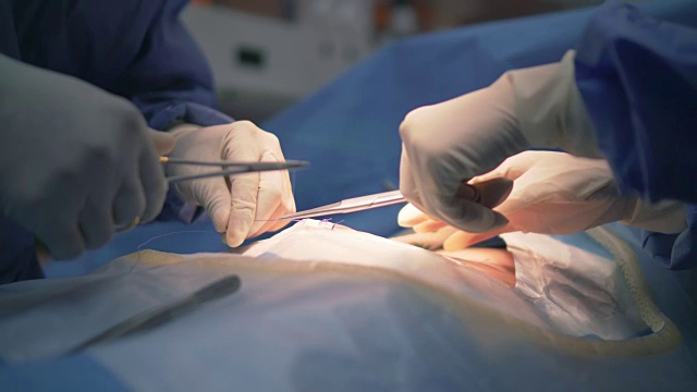 医疗队在手术室进行手术，特写视频素材