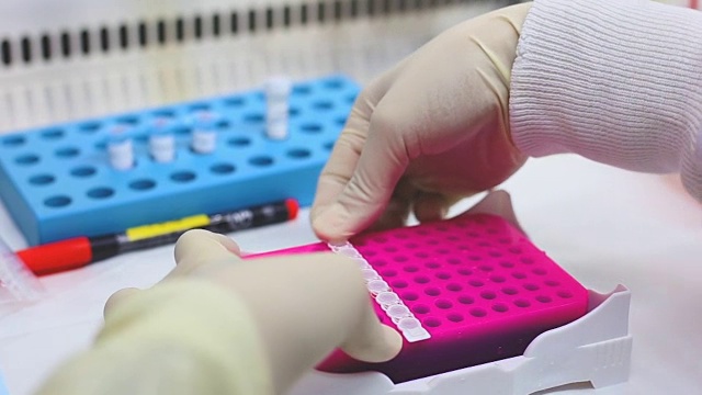 PCR技术的研究视频下载
