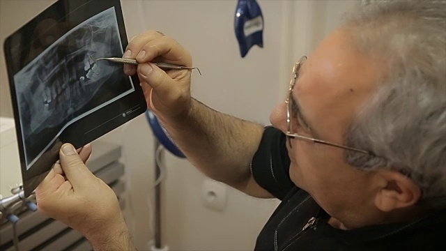 牙医检查和解释牙科x光视频下载