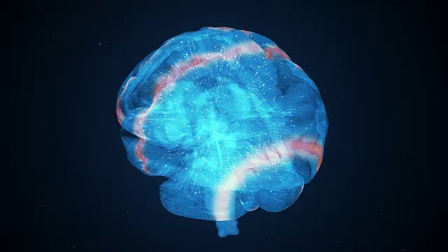 异常的大脑活动和因过度劳累而出现的头痛视频下载