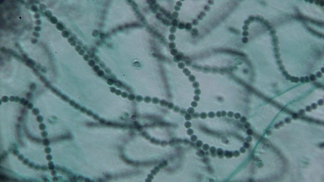显微镜下的珠藻视频下载