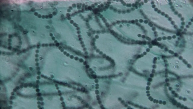 显微镜下的珠藻视频下载