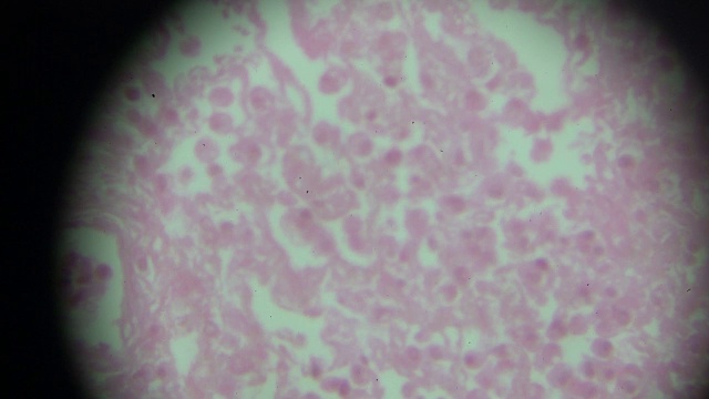 显微镜下的浆细胞视频下载