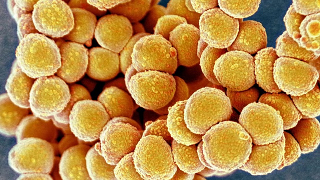 耐甲氧西林金黄色葡萄球菌的细菌,扫描电镜视频下载