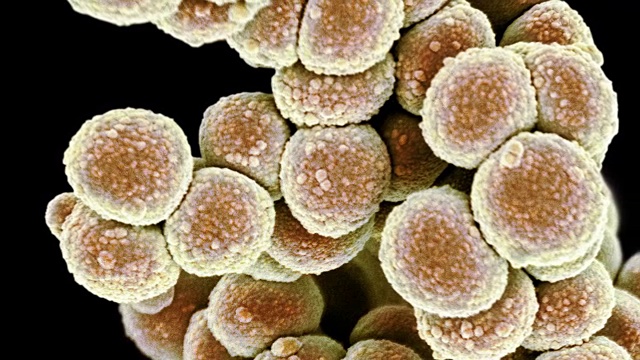 耐甲氧西林金黄色葡萄球菌的细菌,扫描电镜视频下载