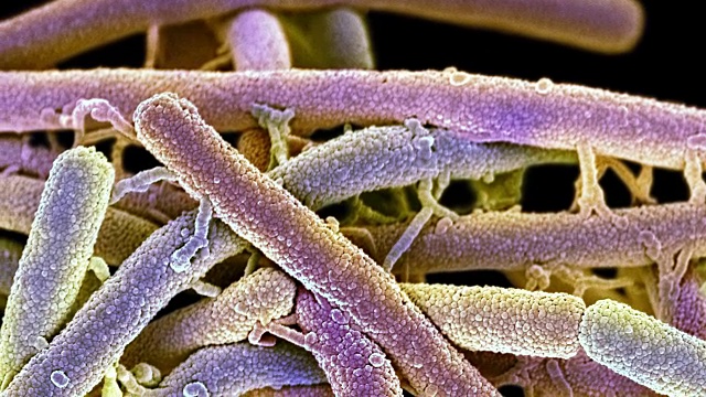 大肠杆菌电镜图片