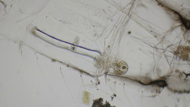 纤毛草履虫在显微镜下为4k视频素材