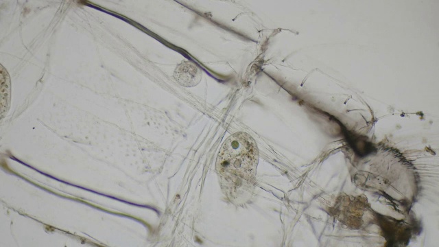 纤毛草履虫在显微镜下为4k视频素材