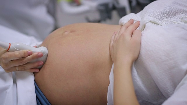 孕妇在做超声波检查。全高清视频视频素材