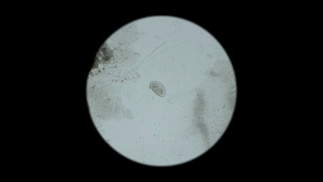 微生物，显微镜下水族馆里的居民，就像外来生物视频下载