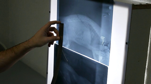 医生在x光照片上用尺子测量骨头的比例视频下载