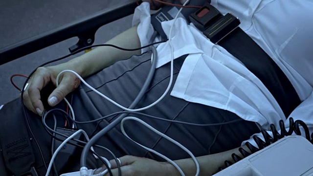 受伤的白人妇女躺在担架上，在车祸后被护理小组照顾视频素材