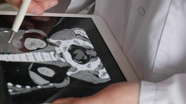 医生检查腹腔计算机断层扫描视频素材
