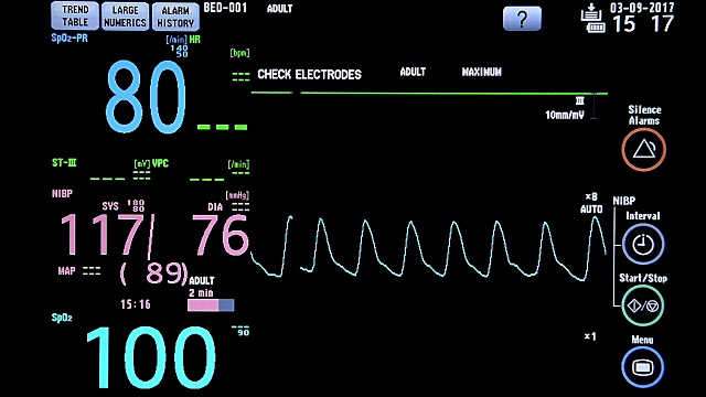 手术室心脏监护仪的关闭。心电监护仪显示患者的心率背景视频购买