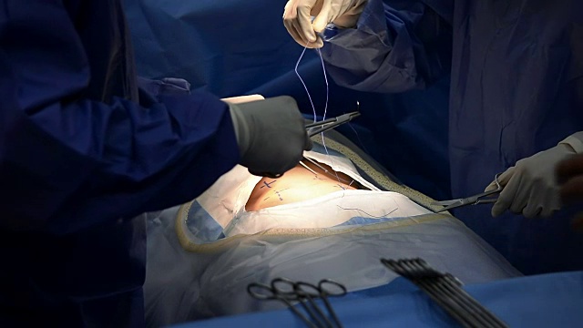 特写外科医生在手术室的实践，一组外科医生团队使用手术设备和手术病人在医院的急诊室视频下载