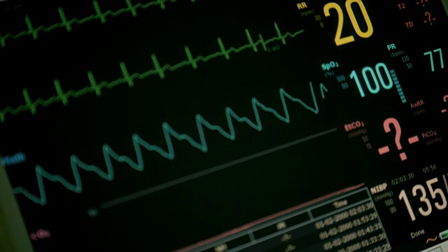 心电监护手术室患者的病情，在屏幕上关闭心跳，聚焦心率、血压。外科医生团队在医院手术室进行手术视频下载