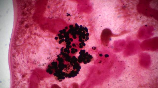 支气管侥幸;Distoma早期;Mesogonimus westermani;Paragonimus westermani;在光学显微镜下视频下载