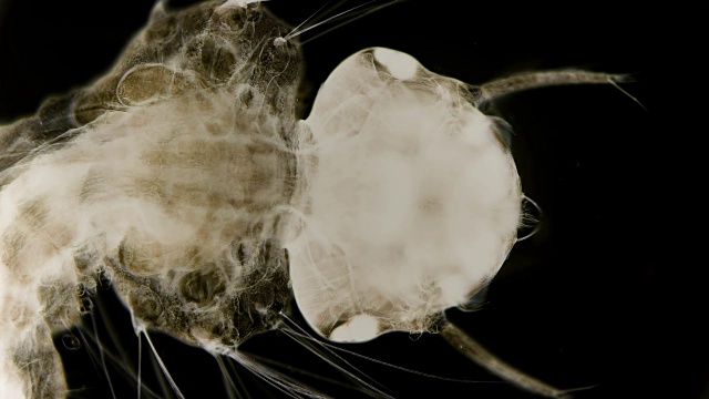 显微镜下的蚊子幼虫视频素材