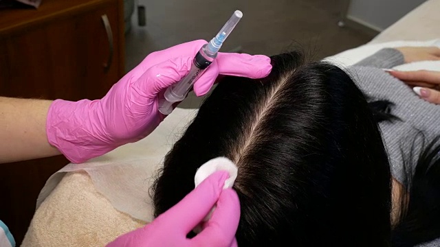 一个漂亮的女人在头部注射之前。这个手术让医生戴上了粉红色的手套。中间疗法的概念。推动以加强头发和它们的生长视频素材