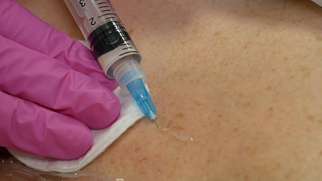 英俊的女人有注射在颈部和胸部皮肤的程序使医生在粉红色的手套。中间疗法的概念视频素材