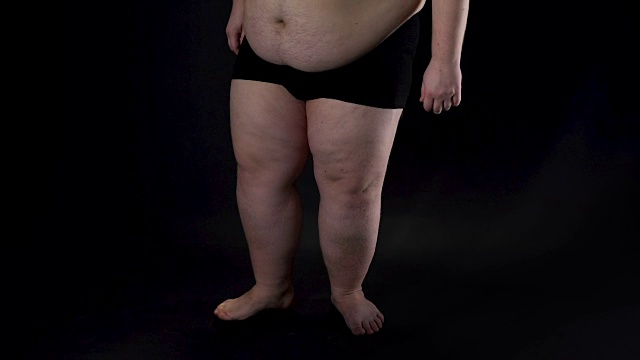 肥胖男性腿上的黑色背景，健康问题，不安全感，疾病视频素材
