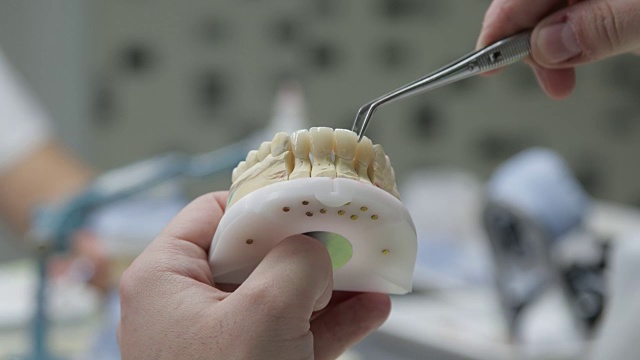 牙科技师将牙桥冠放在石膏上视频素材
