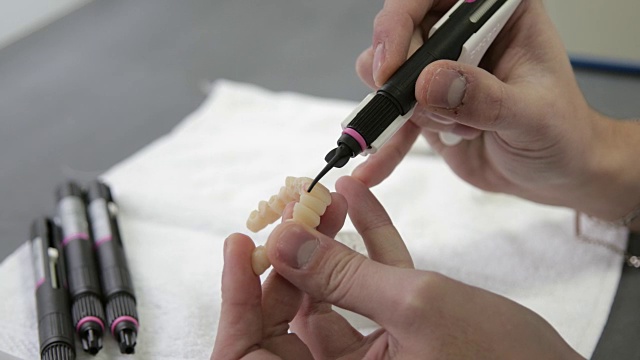 牙科技术员在3D模型上进行牙齿升级视频素材