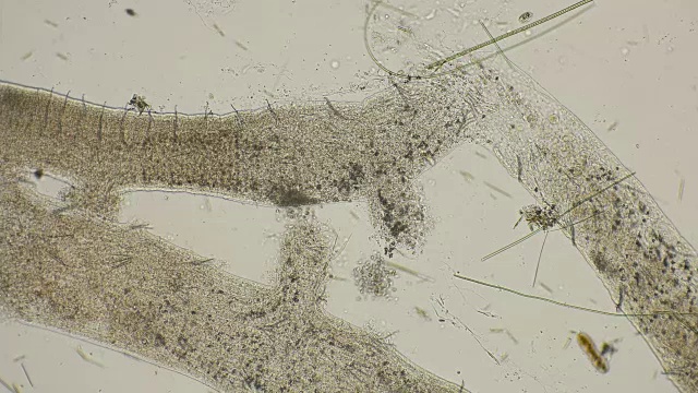 显微镜下观察到的是一群繁殖并吃掉蠕虫的微生物视频素材