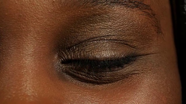 这是女人左眼的照片。视频下载